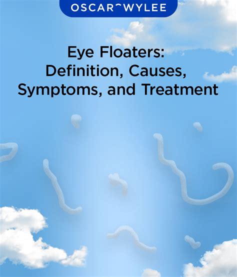 Eye Floaters: Definition, Causes, Symptoms, and Treatment