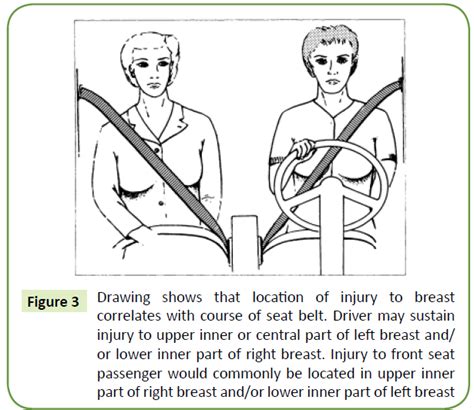 Seat Belt Injuries Symptoms | Elcho Table