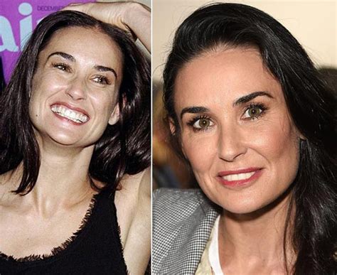 Demi Moore Plastic Surgery - How Much Is Too Much? - Plastic Surgery Talks