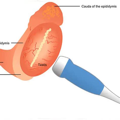 Ultrasound Scrotal Test Procedure