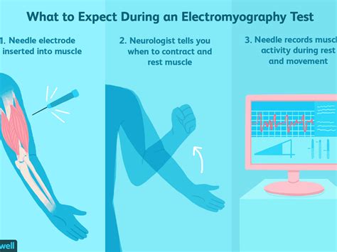 Interpreting Nerve Conduction Study Results - slideshare