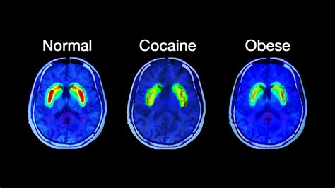 Brain on Sugar — Designed for Thriving