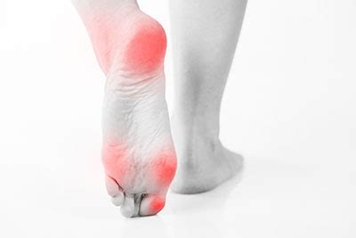 Foot Bursitis: causes, symptoms and treatment | Best Podiatrist Los Angeles