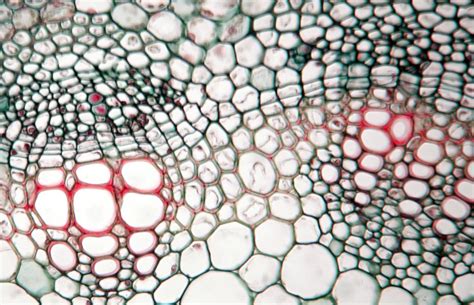 ‎Interfascicular cambium in cross section of Medicago stem - UWDC - UW-Madison Libraries