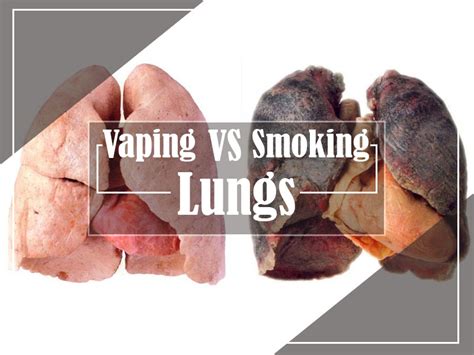 A Study on Vape Lungs vs Smoker Lungs