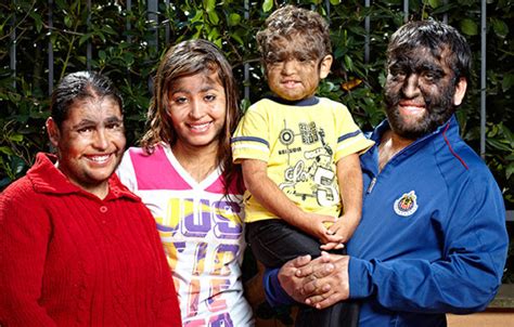 Ramos Gomez family (Largest hairy family) : r/Weird