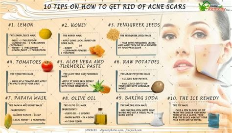 10 Tips on How to get Rid of Acne Scars - Home Remedies