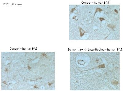 Anti-LAMP1 antibody - Lysosome Marker (ab24170) | Abcam