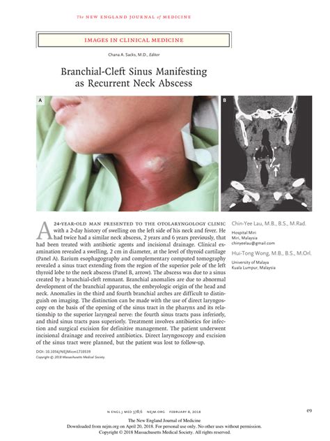 (PDF) Branchial-Cleft Sinus Manifesting as Recurrent Neck Abscess