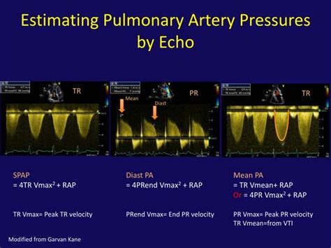 PPT - Role of the Echocardiogram in the Assessment of Pulmonary Hypertension and the Right ...