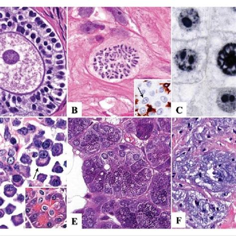 (A) Hematoxylin solution ready for staining. (B) Hematoxylin by itself... | Download Scientific ...