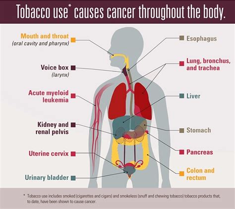 Does Tobacco Cause Cancer? It does something more than that.