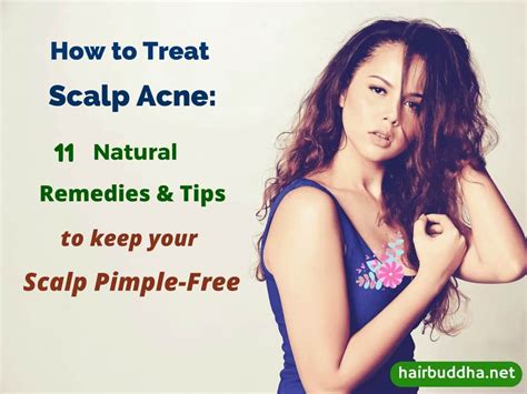 How To Treat Scalp Acne:11 Natural Remedies to Keep Your Scalp Pimple-Free - hair buddha