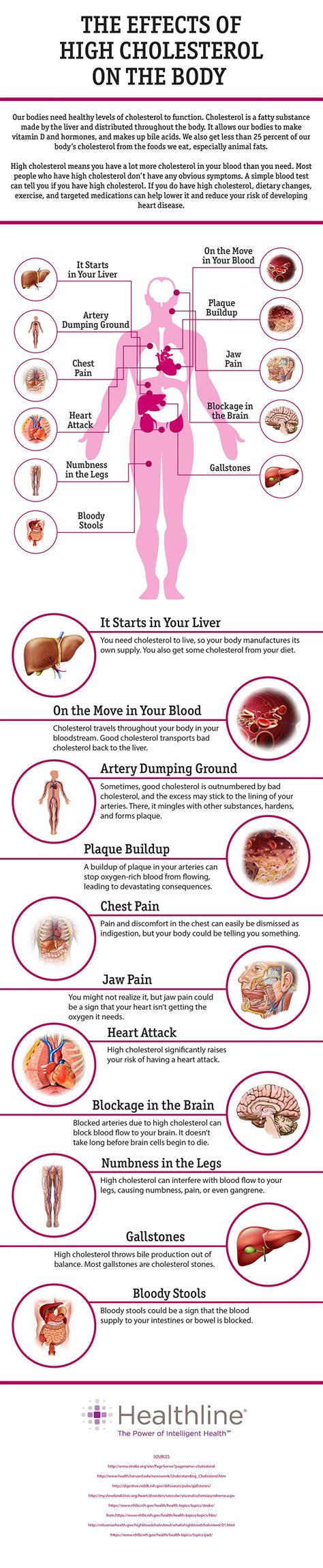 What High Cholesterol Does to Your Body - Dr. Sam Robbins