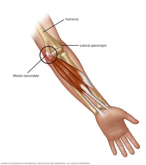 Golfer's elbow - Symptoms and causes - Mayo Clinic