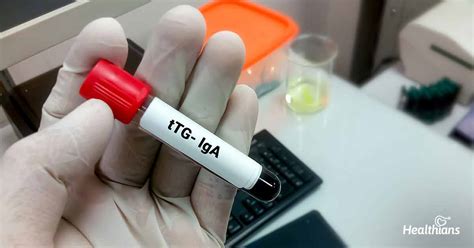 What is a Tissue Transglutaminase IgA, IgG Test? - HEALTHIANS BLOG