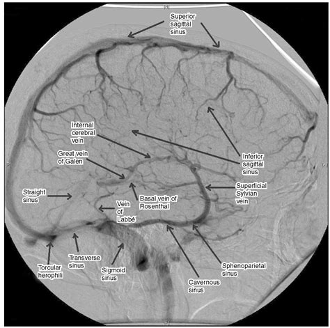 Interventional radiology, Radiology nursing, Radiology