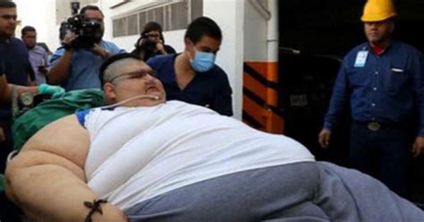 The Fattest Man In The World Is Walking For The First Time In A Decade ...