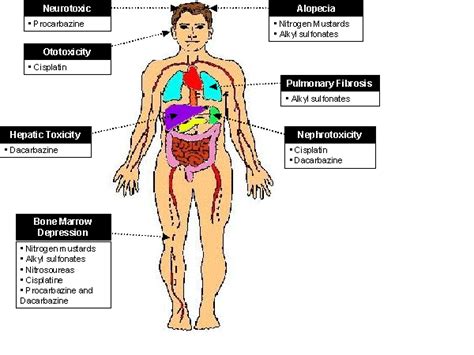 Side Effects of Alkylating Agents