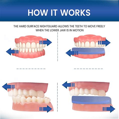 Dental Defense Premium Hard Surface Nightguard 2 Pack - Customizable ...