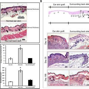 Third-degree burn injury model and skin graft survival. (A) Masson's... | Download Scientific ...