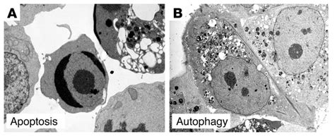 JCI - Autophagy in cell death: an innocent convict?