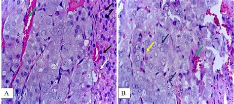 Zona fasciculata of the adrenal glands of rats from the experimental... | Download Scientific ...