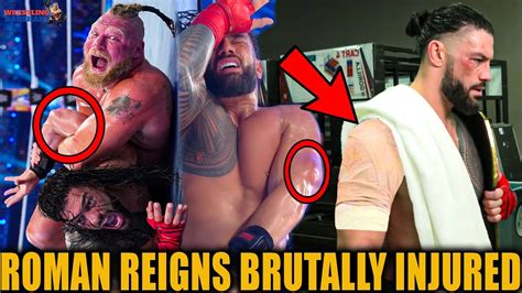 OMG😱 Roman Reigns BRUTALLY INJURED at WrestleMania 38?! Roman vs Brock ...