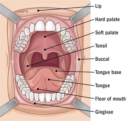 Palate Resection ‣ Cancer Treatment ‣ THANC Guide