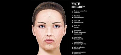 Botox 101: What areas can be treated with Botox? - Bemedispa