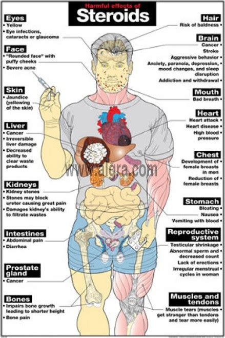 Effects of Steroids Poster - Clinical Charts and Supplies