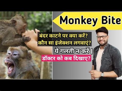 Monkey Bite | monkey bite treatment in hindi | monkey bite first aid ...