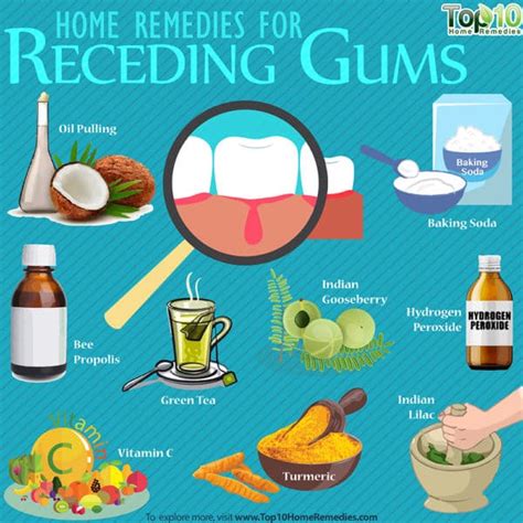 Receding Gums: Home Remedies, Prevention, and Causes | Top 10 Home Remedies