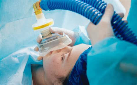 Nitrous Oxide in Anesthesia | Safety in nitrous sedation