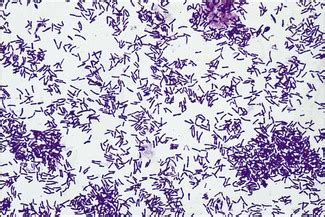 Corynebacterium species and Rhodococcus equi | Veterian Key