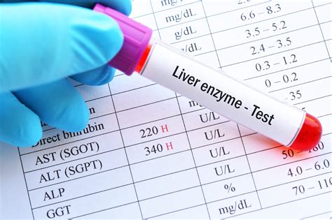 Examining Serum Hepatic Enzymes, Lipid Profile, and Glycemic Control in ...