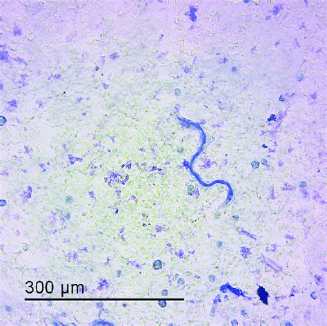 Giemsa-stained Dirofilaria immitis microfilaria (400X). | Download ...