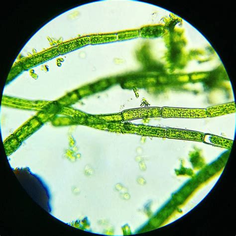 The green world of algae 💚 . . #microscopy #microscope #biology #science #hobby #microbiology # ...