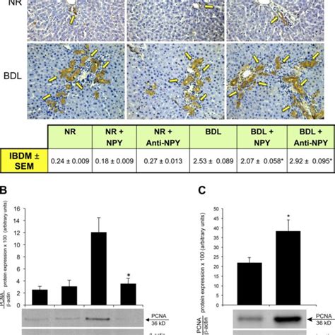 Expression of neuropeptide Y receptors (NPYR) in liver. Y1-Y6 receptor ...