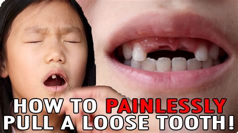 how to pull a tooth at home with string - Arcelia Currie