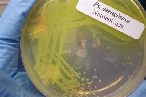 Pseudomonas aeruginosa - EcuRed