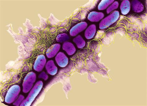 Erwinia Bacteria, Tem Photograph by Dr Kari Lounatmaa