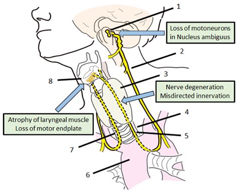 Genes | Free Full-Text | Gene Therapy for Recurrent Laryngeal Nerve Injury