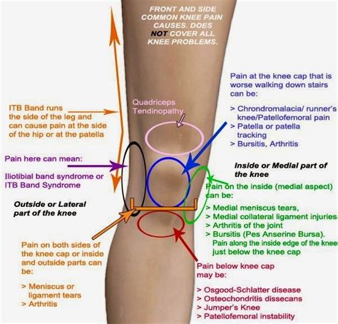 KNEE PAIN EXPLAINED