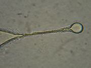 Category:Scyphozoa anatomy - Wikimedia Commons