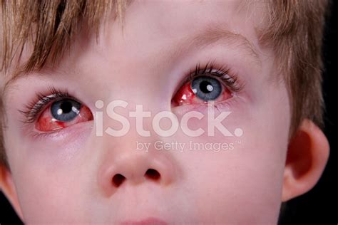 Eye Surgery Recovery 3. Stock Photo | Royalty-Free | FreeImages