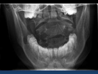 Radiographic MSK Anatomy | PPT