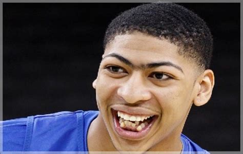 Anthony Davis' Teeth: A Dental Perspective - Web DMD