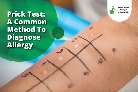 Prick Test Method To Diagnose Allergy | | BVAAC - Dr. Paul Jantzi