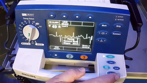 Transcutaneous Pacing - YouTube